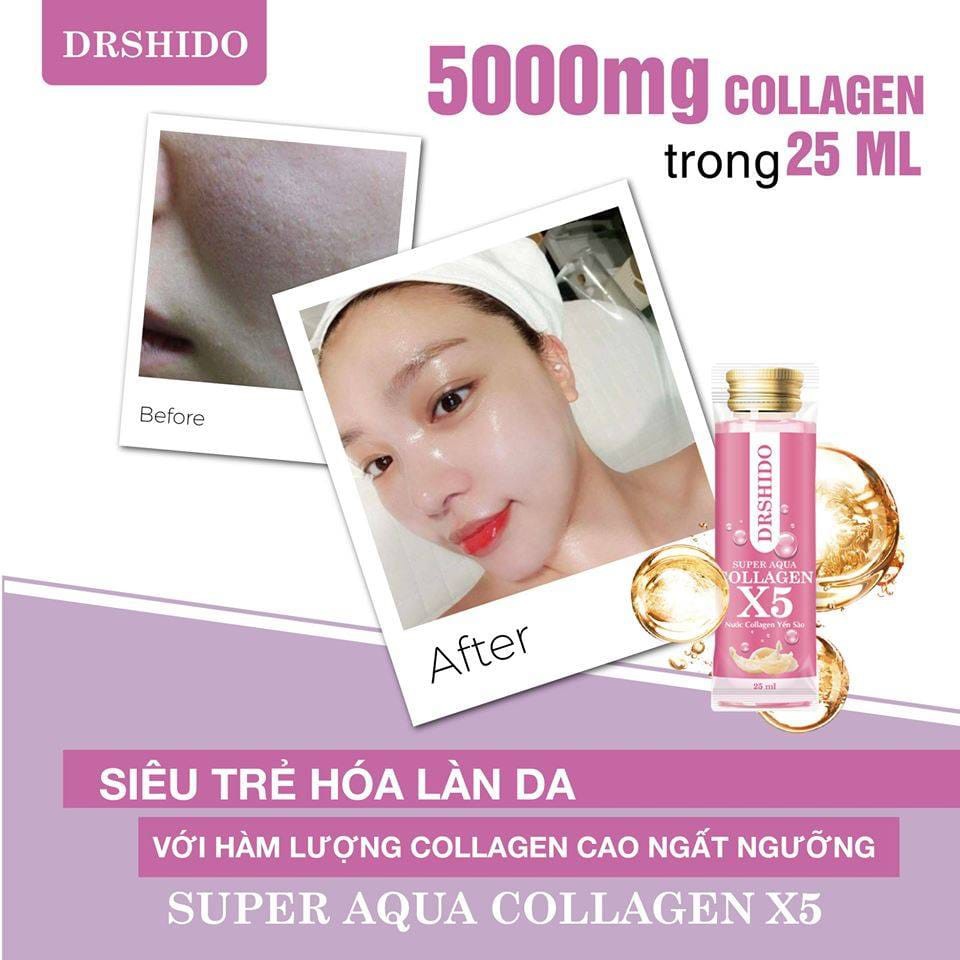 review-Super-Aqua-Collagen-X5 2